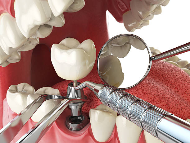 Best Emergency Gum Treatment in Ephraim, UT